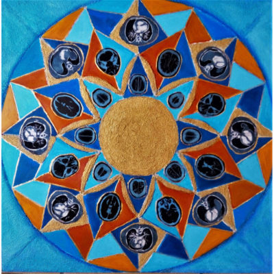 "Lotus bleu"